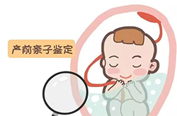 眉山产前亲子鉴定流程是怎样的呢，眉山正规孕期亲子鉴定机构在哪里